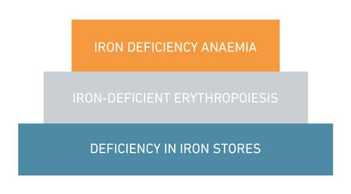 A three-tiered diagram with orange, gray, and blue sections labeled: "Iron Deficiency Anemia," "Iron-Deficient Erythropoiesis," "Low Iron Stores."