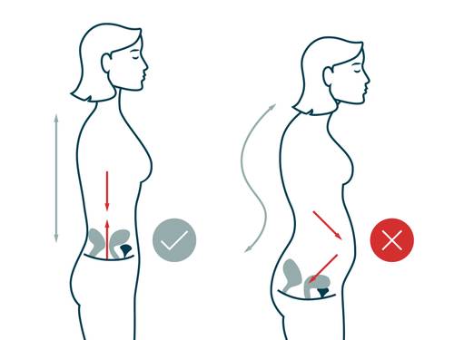 Illustration des Beckenbodens vor (links) und nach (rechts) der Schwangerschaft und Geburt. Links ist der Rücken gerade, rechts eher gebogen, weshalb sich der Beckenboden verändert.