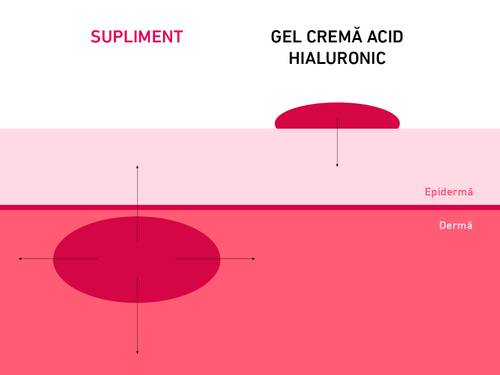 Diagramă care arată efectele unui supliment și ale unei creme cu acid hialuronic asupra straturilor pielii – etichetate „epiderm” și „derm”.