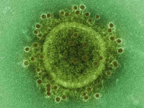 Imagine microscopică cu nuanță verde a unui virus cu formă circulară și proiecții asemănătoare unor țepi,