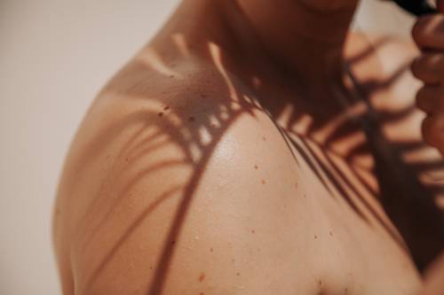 Close-up of a person's bare shoulder with shadows of palm fronds cast across the skin, creating a pattern on a sunlit background.